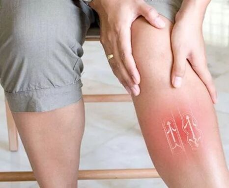 Venous blood flow dysfunction in the lower limb