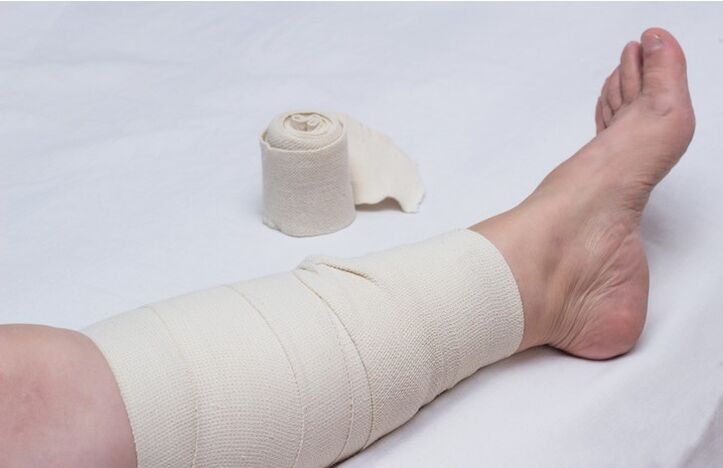 compression bandage for varicose veins